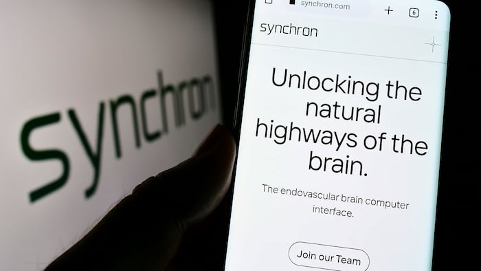Synchron