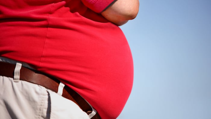Obesity