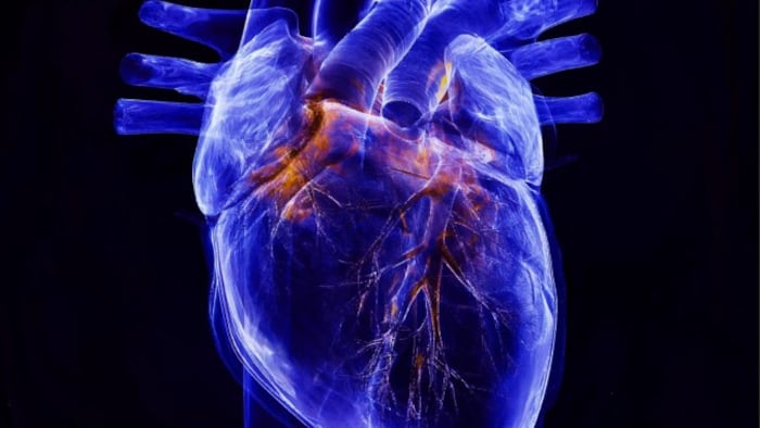Heart X-ray film