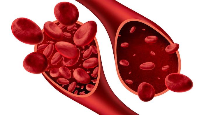 illustration of anemia