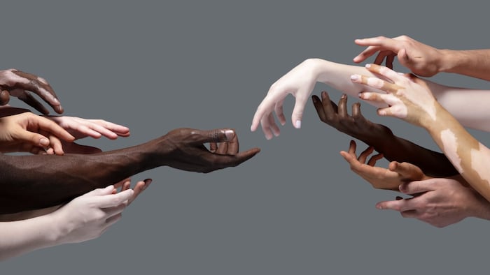diversity
